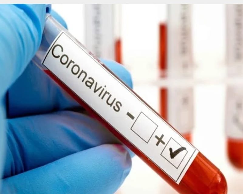 EXISTEN 10 CASOS POSITIVOS DE CORONAVIRUS EN TIERRA DEL FUEGO EXISTEN 10 CASOS POSITIVOS DE CORONAVIRUS EN TIERRA DEL FUEGO