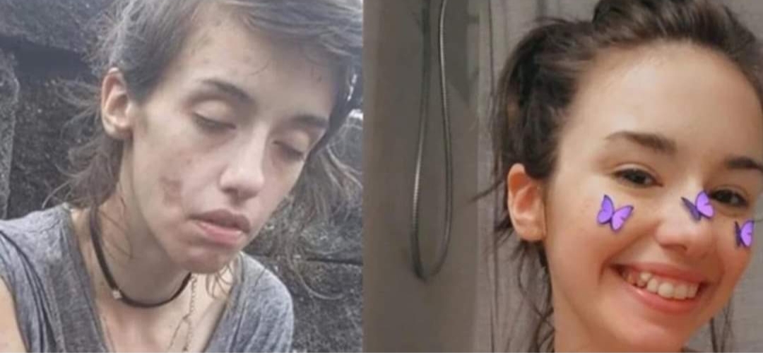 La desgarradora imagen de una joven adicta a las drogas y su poderoso mensaje La desgarradora imagen de una joven adicta a las drogas y su poderoso mensaje