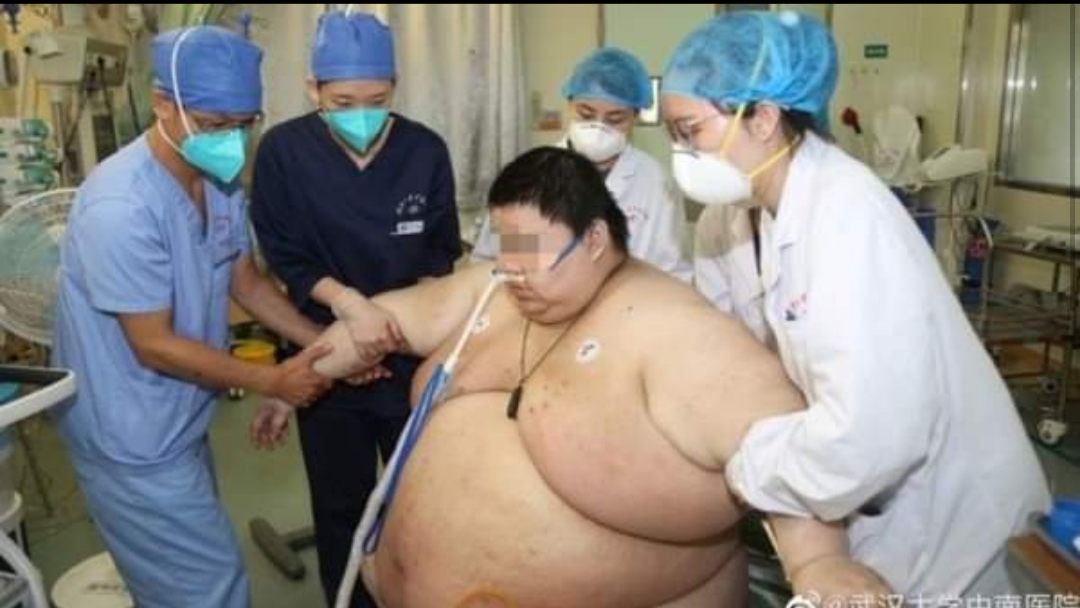 Coronavirus: estuvo cinco meses en cuarentena, llegó a pesar 280 kilos y los médicos no querían atenderlo Coronavirus: estuvo cinco meses en cuarentena, llegó a pesar 280 kilos y los médicos no querían atenderlo