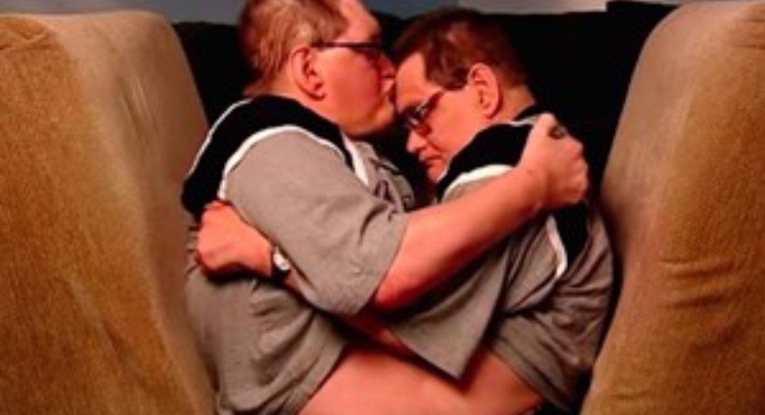 Murieron los hermanos siameses más longevos del mundo: vivieron 68 años con sus cuerpos unidos Murieron los hermanos siameses más longevos del mundo: vivieron 68 años con sus cuerpos unidos