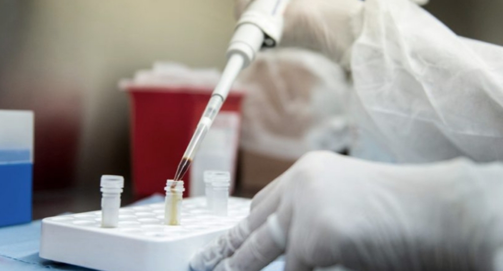 Argentina fue elegida para probar una vacuna contra el coronavirus Argentina fue elegida para probar una vacuna contra el coronavirus