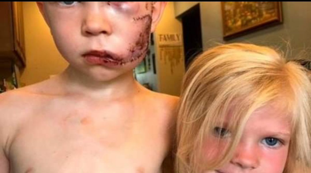 Un niño salvó a su hermana atacada por un perro en Estados Unidos: «si alguien debía morir, tenía que ser yo» Un niño salvó a su hermana atacada por un perro en Estados Unidos: «si alguien debía morir, tenía que ser yo»