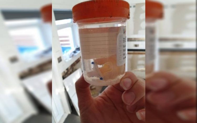 Se mudó y en su nueva casa encontró un órgano en un frasco Se mudó y en su nueva casa encontró un órgano en un frasco