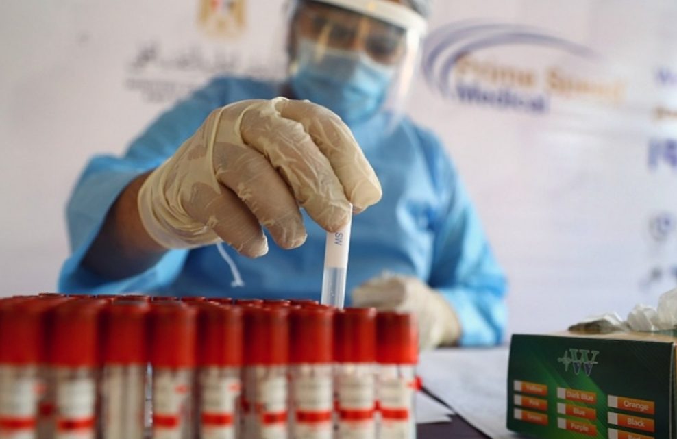 Covid-19: un estudio argentino demuestra que 95% de pacientes desarrolló anticuerpos a los 45 días Covid-19: un estudio argentino demuestra que 95% de pacientes desarrolló anticuerpos a los 45 días