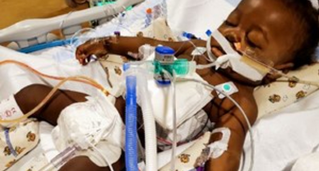 El «bebé milagro» que superó el coronavirus y un trasplante de hígado El «bebé milagro» que superó el coronavirus y un trasplante de hígado