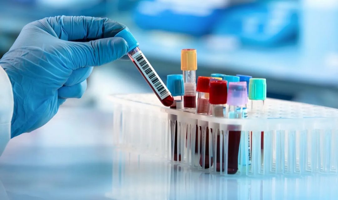 La Anmat aprobó el test argentino para la detección rápida de coronavirus La Anmat aprobó el test argentino para la detección rápida de coronavirus
