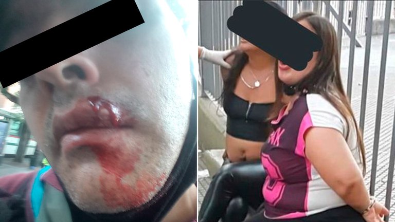 Un policía les pidió a dos mujeres que se pusieran el barbijo: lo atacaron a piedrazos y lo enviaron al hospital Un policía les pidió a dos mujeres que se pusieran el barbijo: lo atacaron a piedrazos y lo enviaron al hospital